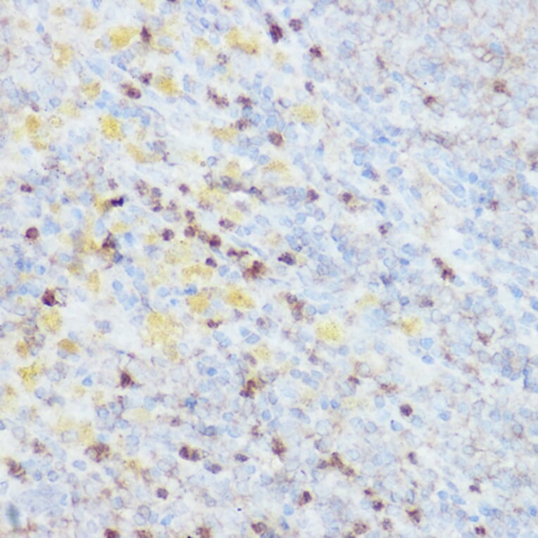 Immunohistochemistry - Anti-HEF1/NEDD-9 Antibody (A14030) - Antibodies.com