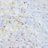 Immunohistochemistry - Anti-HEF1/NEDD-9 Antibody (A14030) - Antibodies.com