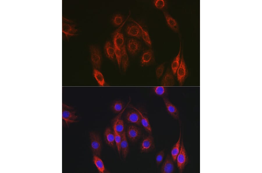Immunofluorescence - Anti-HEF1/NEDD-9 Antibody (A14030) - Antibodies.com