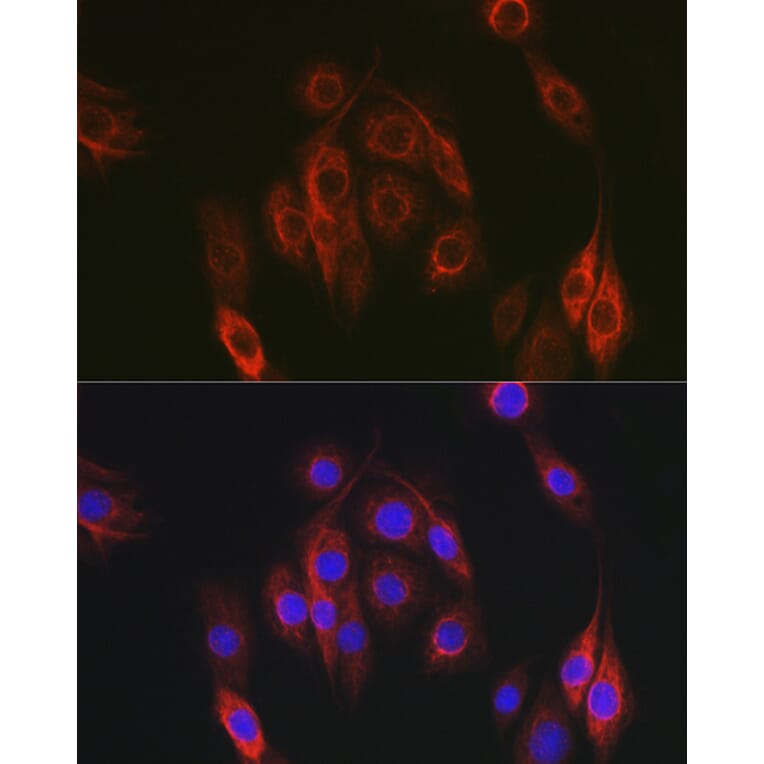 Immunofluorescence - Anti-HEF1/NEDD-9 Antibody (A14030) - Antibodies.com