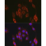 Immunofluorescence - Anti-HEF1/NEDD-9 Antibody (A14030) - Antibodies.com