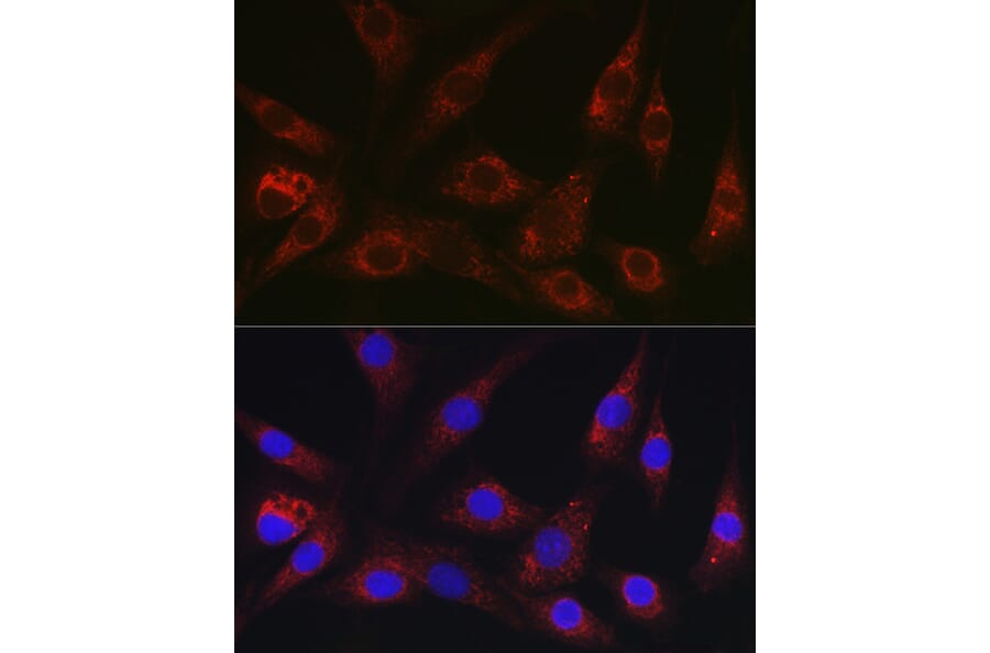 Immunofluorescence - Anti-HEF1/NEDD-9 Antibody (A14030) - Antibodies.com