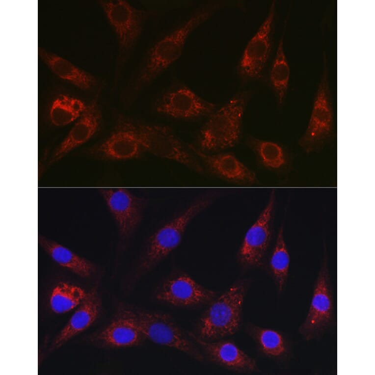 Immunofluorescence - Anti-HEF1/NEDD-9 Antibody (A14030) - Antibodies.com