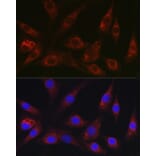 Immunofluorescence - Anti-HEF1/NEDD-9 Antibody (A14030) - Antibodies.com