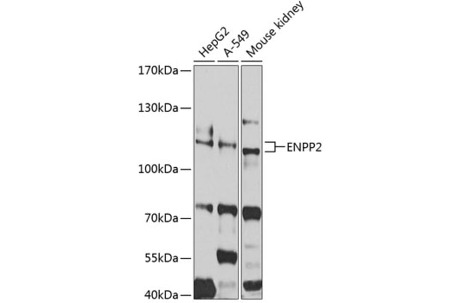Western Blot - Anti-ENPP2/ATX Antibody (A14031) - Antibodies.com