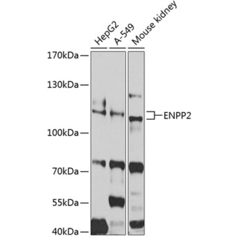 Western Blot - Anti-ENPP2/ATX Antibody (A14031) - Antibodies.com