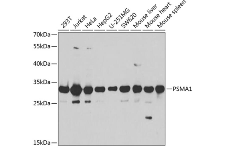 Western Blot - Anti-Proteasome 20S C2/HC2 Antibody (A14032) - Antibodies.com
