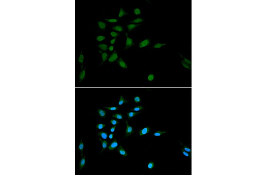 Immunofluorescence - Anti-Proteasome 20S C2/HC2 Antibody (A14032) - Antibodies.com