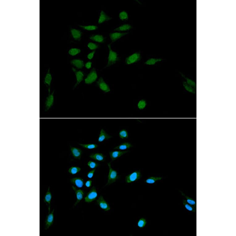 Immunofluorescence - Anti-Proteasome 20S C2/HC2 Antibody (A14032) - Antibodies.com