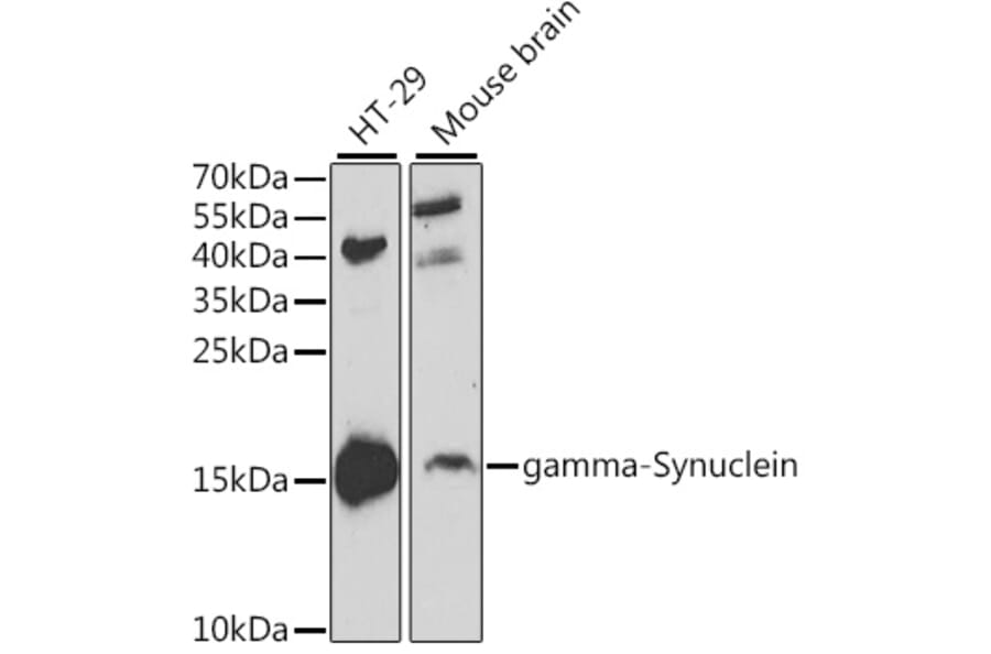 Western Blot - Anti-gamma Synuclein/SNCG Antibody (A14033) - Antibodies.com