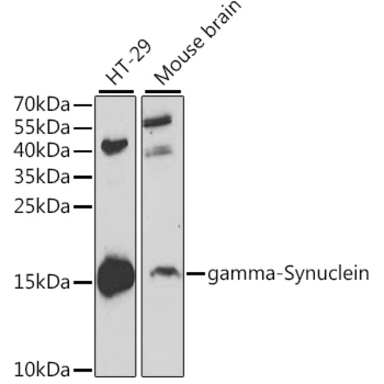 Western Blot - Anti-gamma Synuclein/SNCG Antibody (A14033) - Antibodies.com