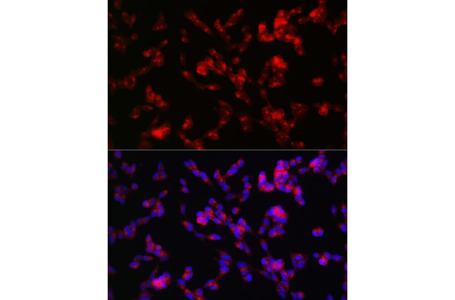 Immunofluorescence - Anti-ADAMTS4 Antibody (A14034) - Antibodies.com