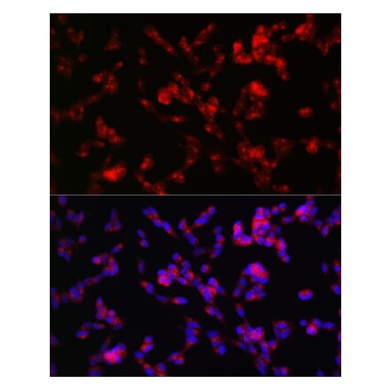 Immunofluorescence - Anti-ADAMTS4 Antibody (A14034) - Antibodies.com