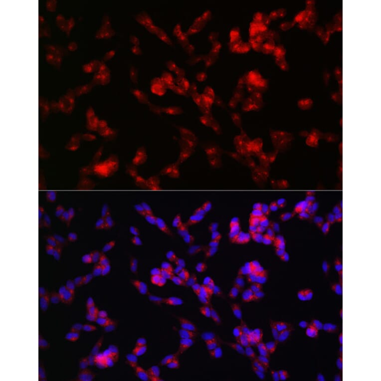 Immunofluorescence - Anti-ADAMTS4 Antibody (A14034) - Antibodies.com