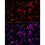 Immunofluorescence - Anti-ADAMTS4 Antibody (A14034) - Antibodies.com