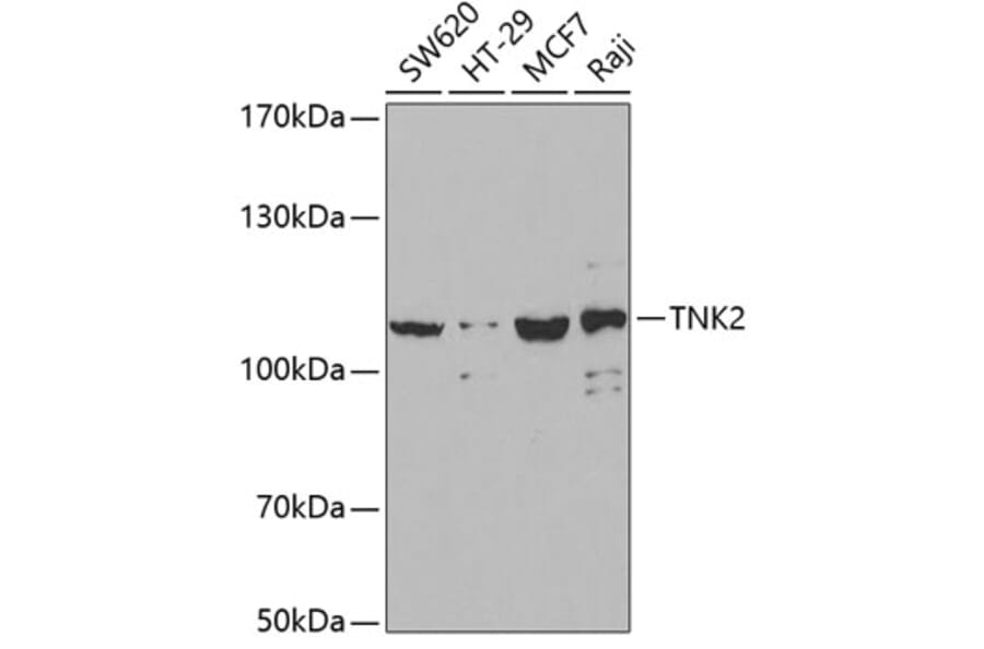 Western Blot - Anti-ACK1 Antibody (A14035) - Antibodies.com