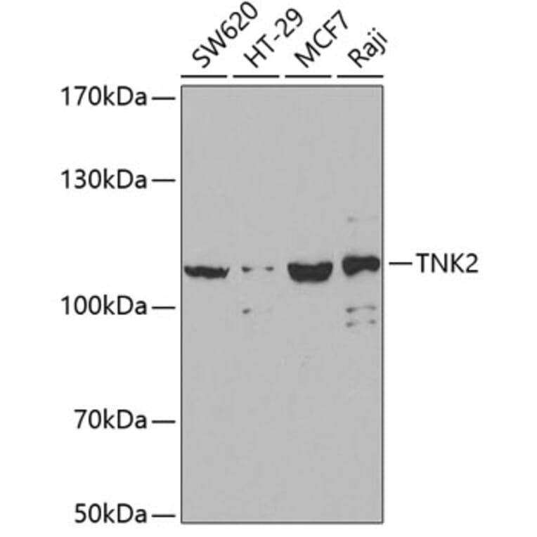 Western Blot - Anti-ACK1 Antibody (A14035) - Antibodies.com