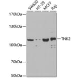 Western Blot - Anti-ACK1 Antibody (A14035) - Antibodies.com