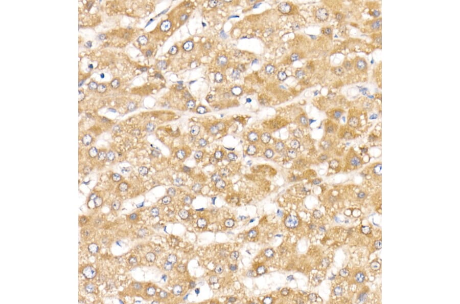 Immunohistochemistry - Anti-ACK1 Antibody (A14035) - Antibodies.com