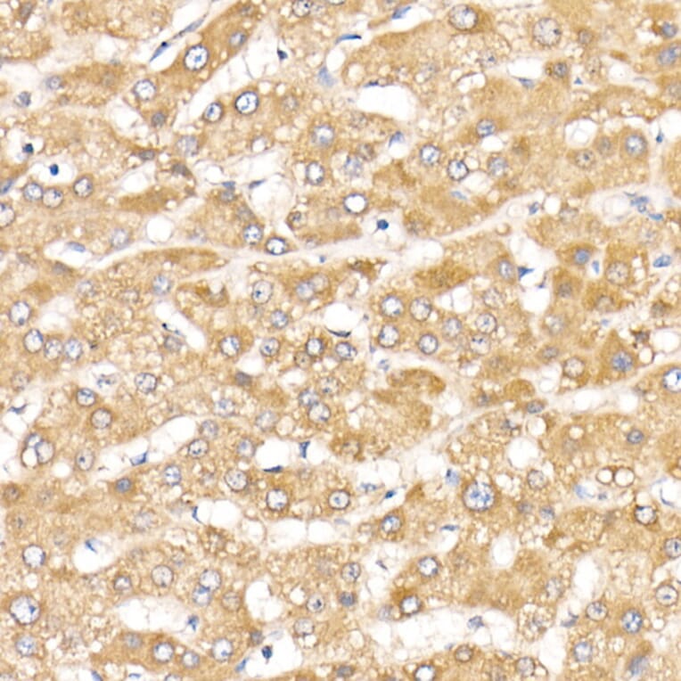 Immunohistochemistry - Anti-ACK1 Antibody (A14035) - Antibodies.com