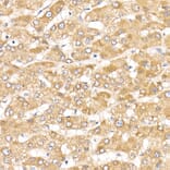 Immunohistochemistry - Anti-ACK1 Antibody (A14035) - Antibodies.com