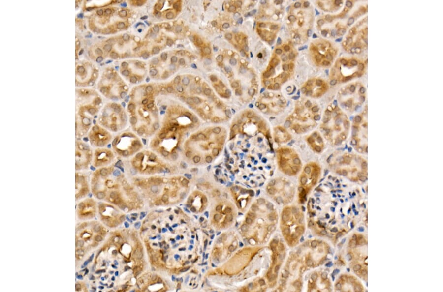 Immunohistochemistry - Anti-ACK1 Antibody (A14035) - Antibodies.com