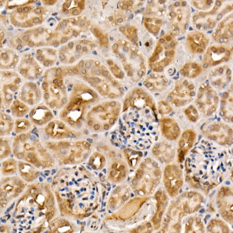 Immunohistochemistry - Anti-ACK1 Antibody (A14035) - Antibodies.com