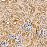 Immunohistochemistry - Anti-ACK1 Antibody (A14035) - Antibodies.com