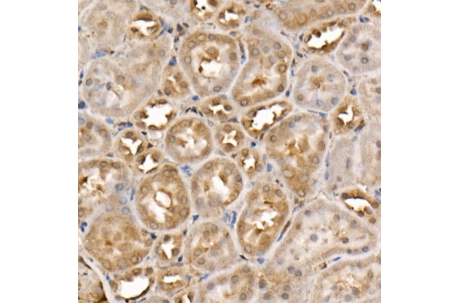 Immunohistochemistry - Anti-ACK1 Antibody (A14035) - Antibodies.com