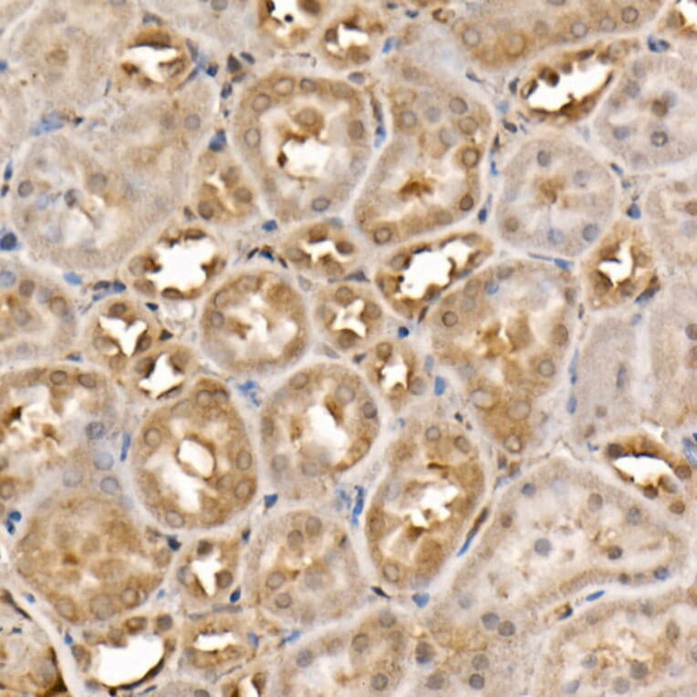 Immunohistochemistry - Anti-ACK1 Antibody (A14035) - Antibodies.com
