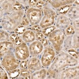 Immunohistochemistry - Anti-ACK1 Antibody (A14035) - Antibodies.com