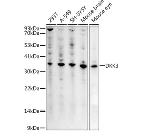 Western Blot - Anti-Dkk3 Antibody (A14036) - Antibodies.com