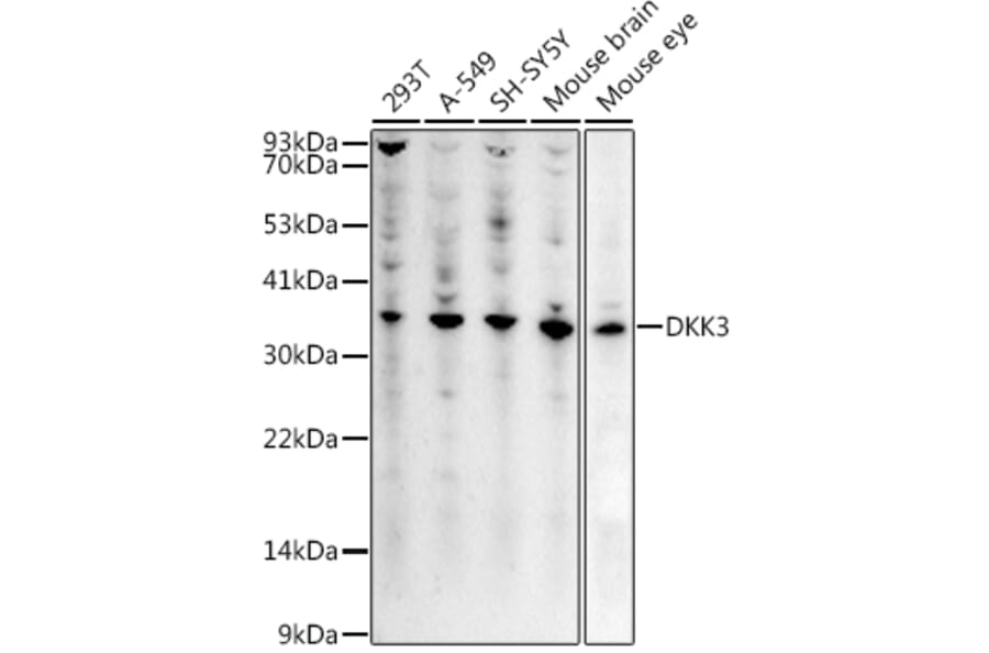 Western Blot - Anti-Dkk3 Antibody (A14036) - Antibodies.com