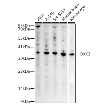 Western Blot - Anti-Dkk3 Antibody (A14036) - Antibodies.com