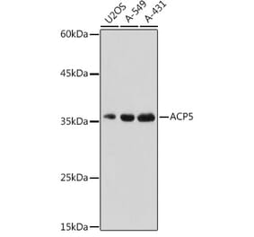 Western Blot - Anti-Tartrate Resistant Acid Phosphatase Antibody (A14037) - Antibodies.com