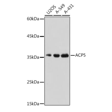 Western Blot - Anti-Tartrate Resistant Acid Phosphatase Antibody (A14037) - Antibodies.com