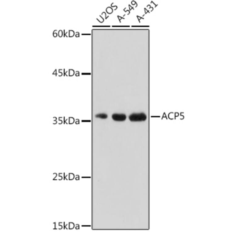 Western Blot - Anti-Tartrate Resistant Acid Phosphatase Antibody (A14037) - Antibodies.com
