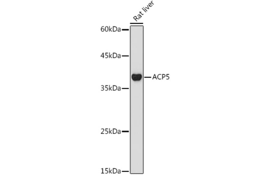 Western Blot - Anti-Tartrate Resistant Acid Phosphatase Antibody (A14037) - Antibodies.com