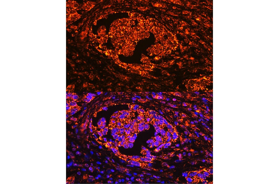 Immunofluorescence - Anti-Tartrate Resistant Acid Phosphatase Antibody (A14037) - Antibodies.com