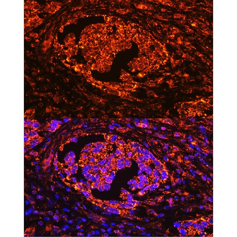 Immunofluorescence - Anti-Tartrate Resistant Acid Phosphatase Antibody (A14037) - Antibodies.com
