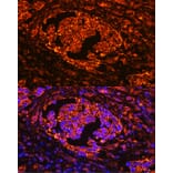 Immunofluorescence - Anti-Tartrate Resistant Acid Phosphatase Antibody (A14037) - Antibodies.com