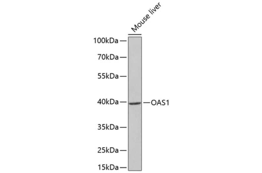 Western Blot - Anti-OAS1 Antibody (A14038) - Antibodies.com