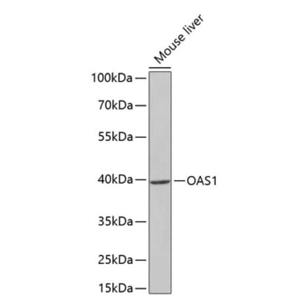 Western Blot - Anti-OAS1 Antibody (A14038) - Antibodies.com