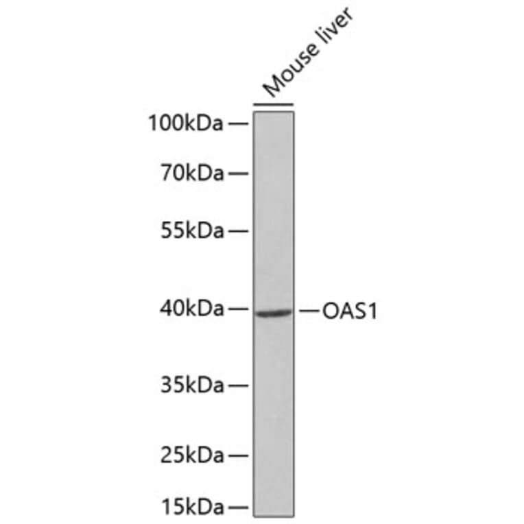 Western Blot - Anti-OAS1 Antibody (A14038) - Antibodies.com