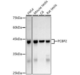 Western Blot - Anti-PCBP2/hnRNP E2 Antibody (A14039) - Antibodies.com