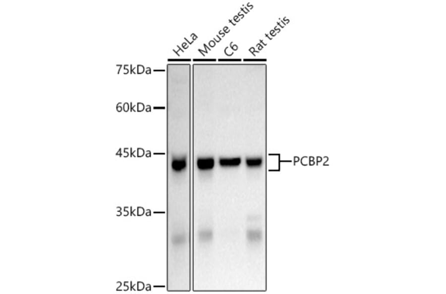 Western Blot - Anti-PCBP2/hnRNP E2 Antibody (A14039) - Antibodies.com