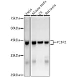 Western Blot - Anti-PCBP2/hnRNP E2 Antibody (A14039) - Antibodies.com
