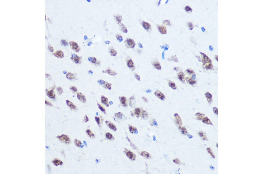 Immunohistochemistry - Anti-PCBP2/hnRNP E2 Antibody (A14039) - Antibodies.com