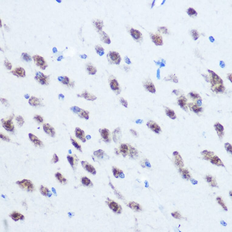Immunohistochemistry - Anti-PCBP2/hnRNP E2 Antibody (A14039) - Antibodies.com