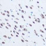 Immunohistochemistry - Anti-PCBP2/hnRNP E2 Antibody (A14039) - Antibodies.com